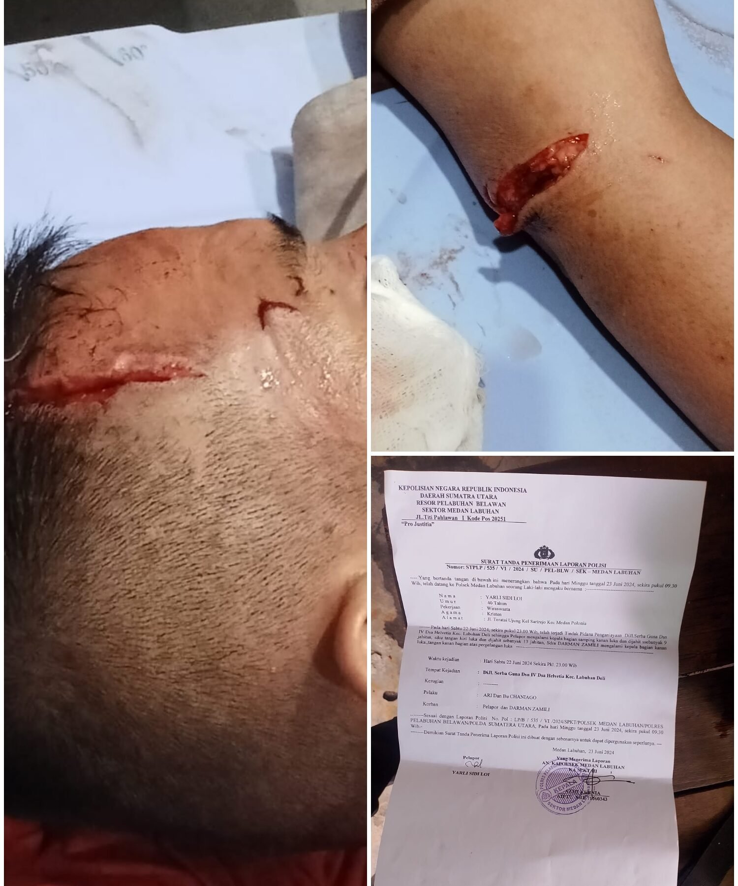 Kondisi korban ketika usai mengalami pembacokan dan LP korban.