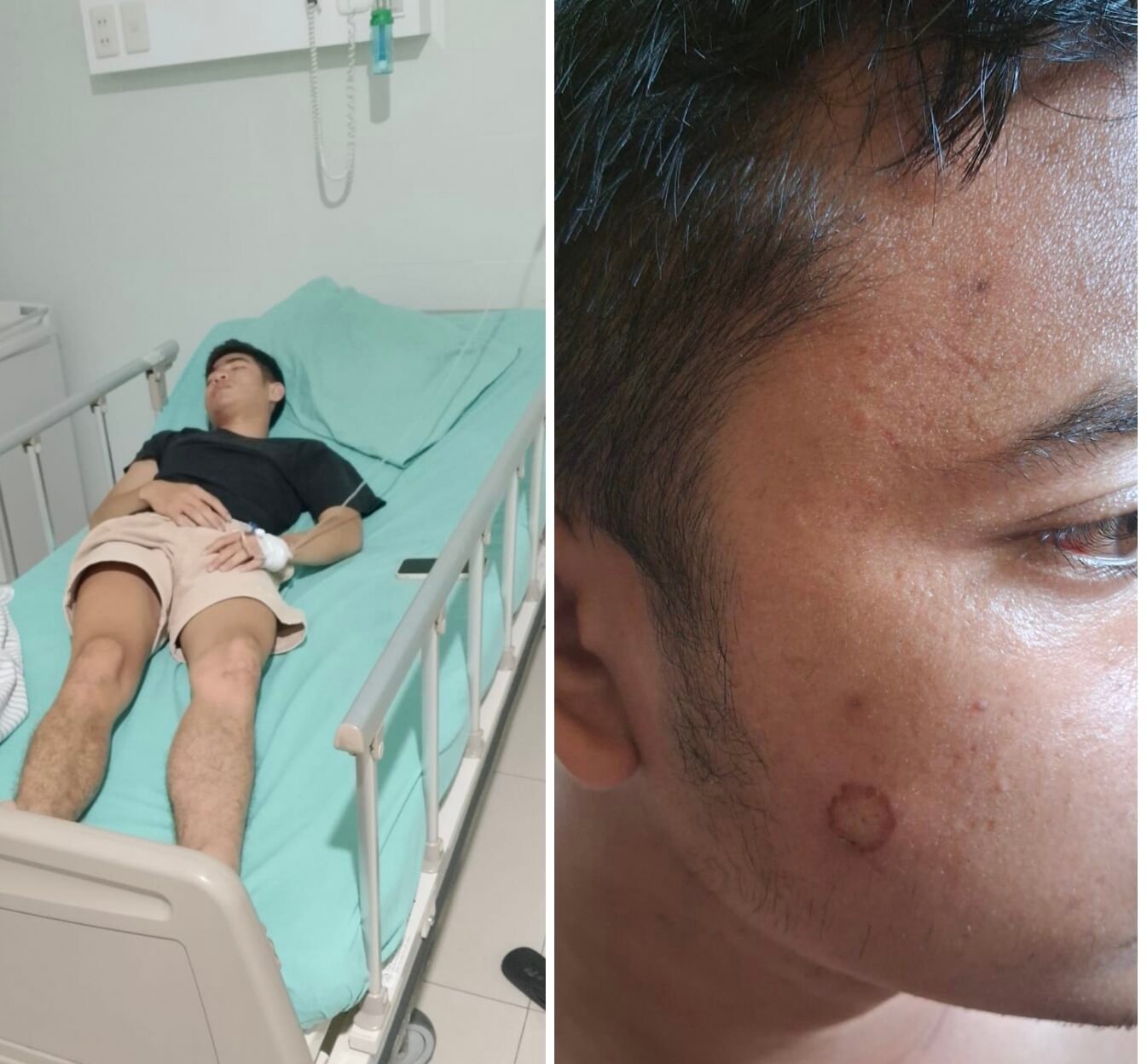 Anak Wartawan dugaan pengeroyokan. 